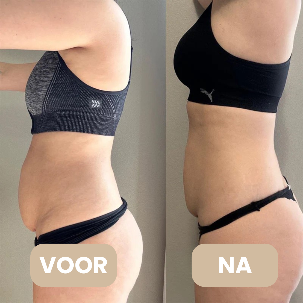 DermaSculpt EMS microstroom detail – spieractivatie en verstrakking – ElleCera