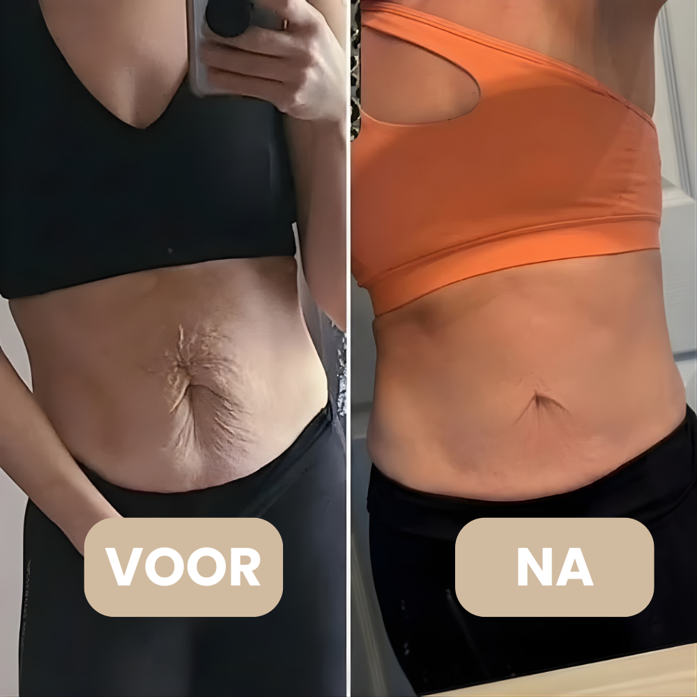 DermaSculpt gebruik op billen – cellulite verminderen thuis – ElleCera