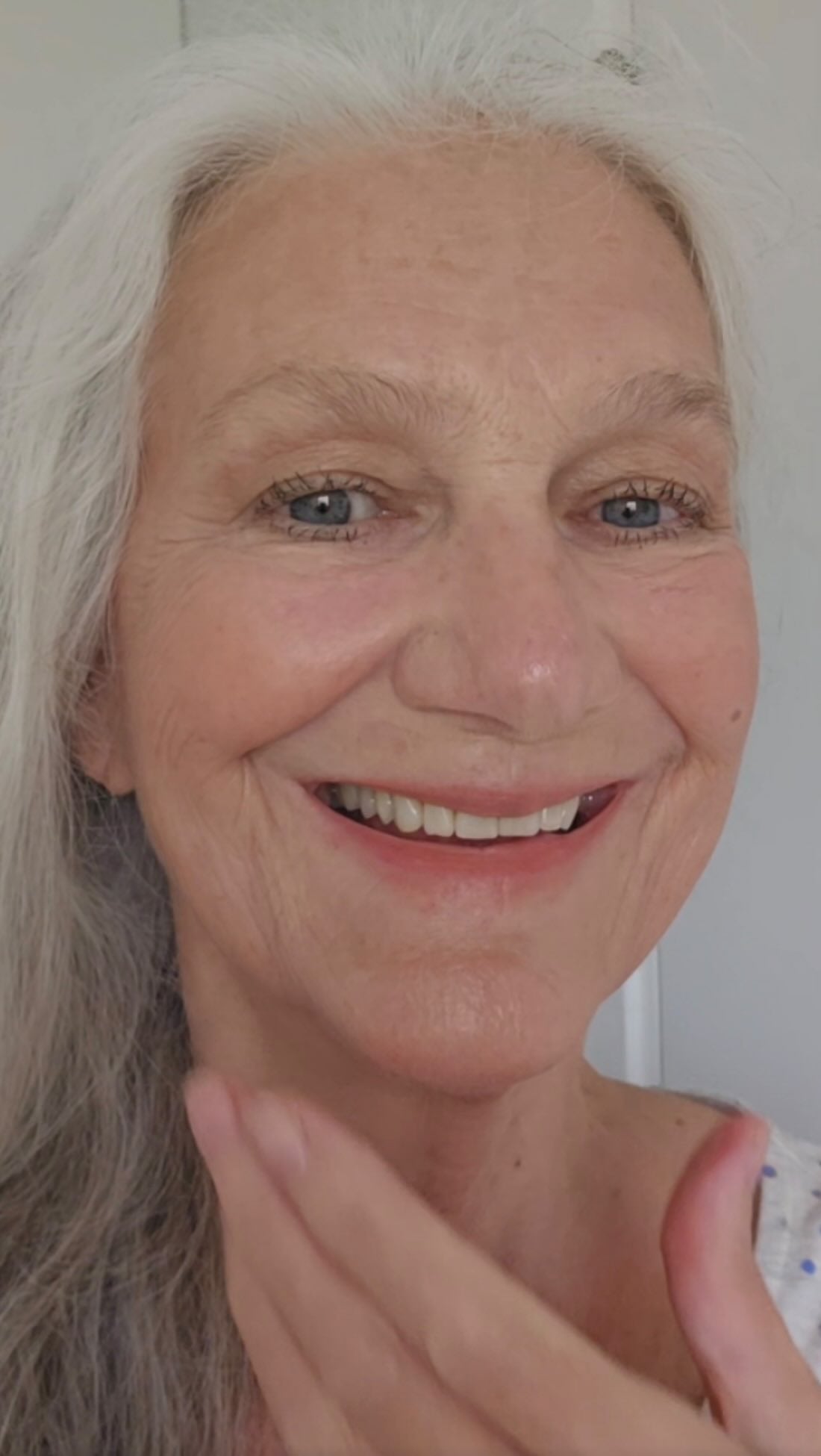 files/microneedling-review-klant-voor-na-resultaat.jpg