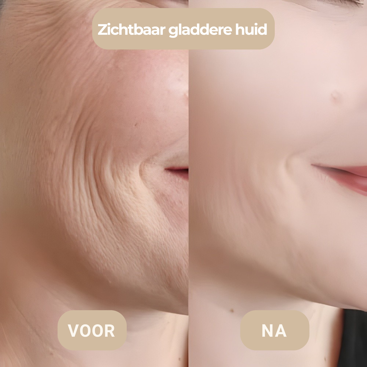 Microneedling voor en na foto – gladdere huidtextuur thuis zonder kliniek – ElleCera